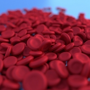Anemia